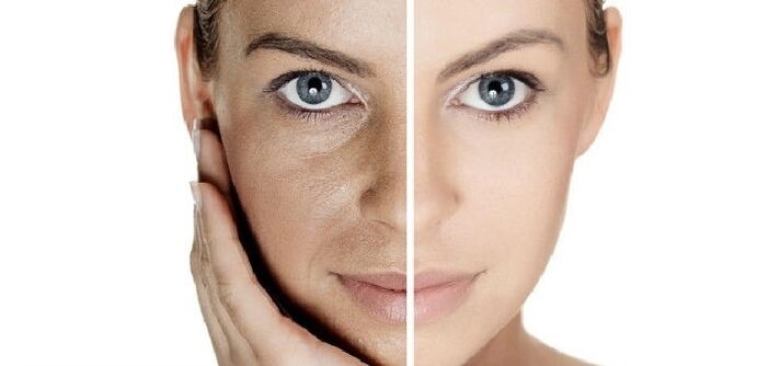pirms un pēc sejas ādas atjaunošanas