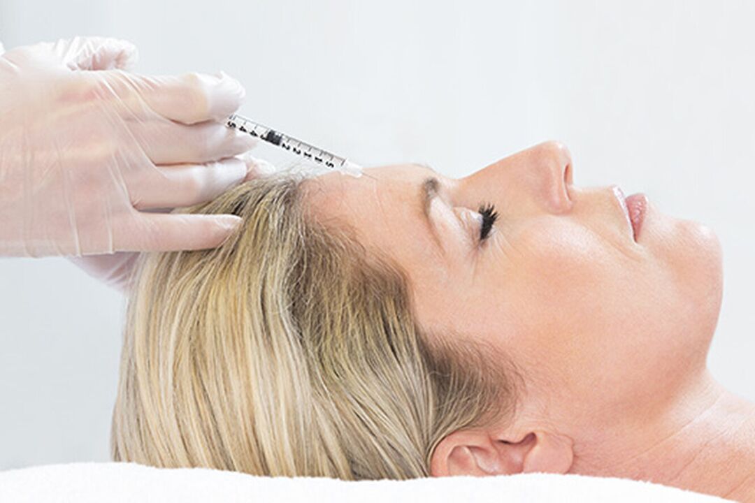 Plazmoliftings ir injekciju metode sejas ādas atjaunošanai